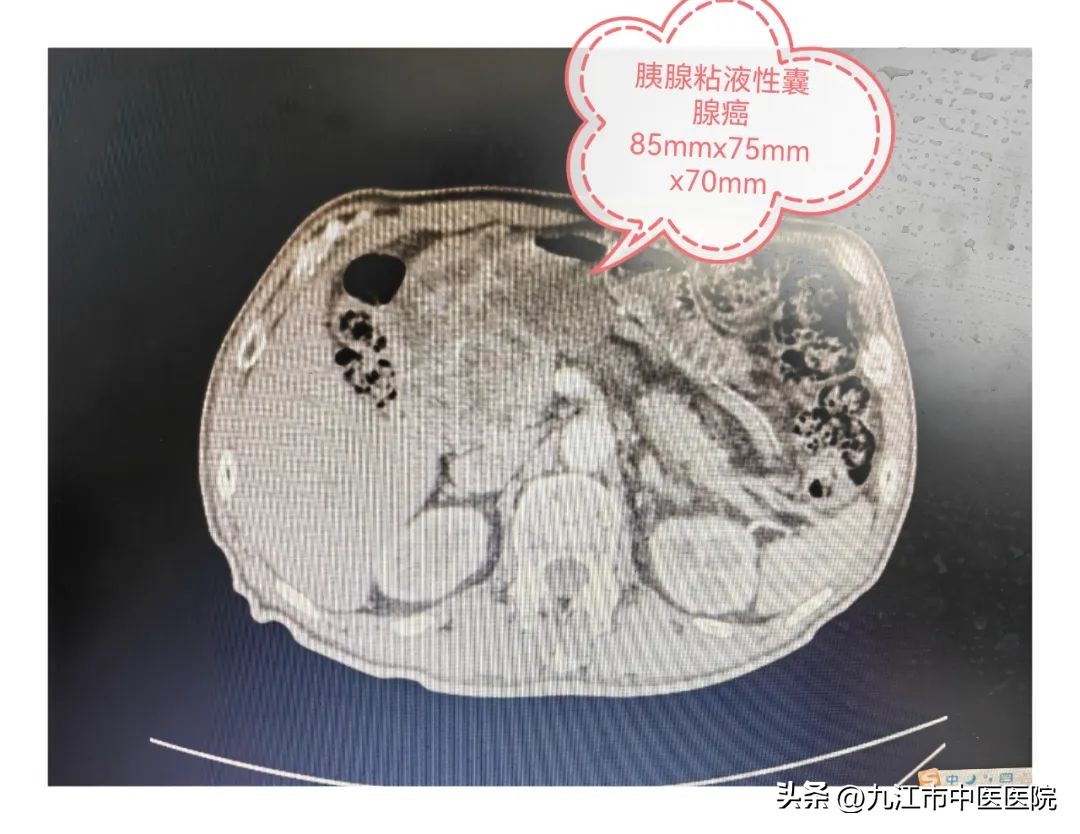 杏林春暖中医治病,杏林春暖完整在线