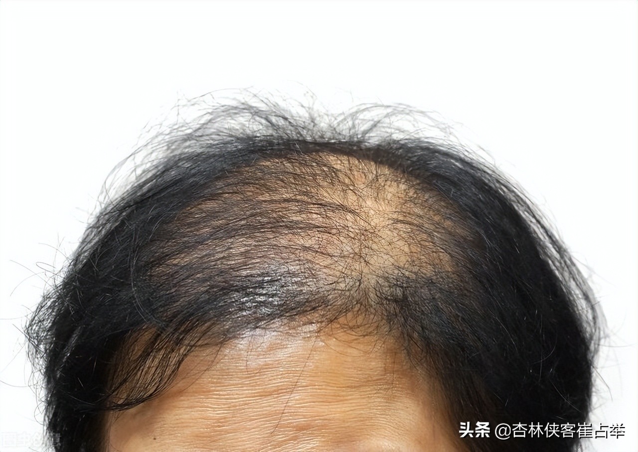 肾的精血不足吃什么中草药,气血不足精血也不足吃什么中药