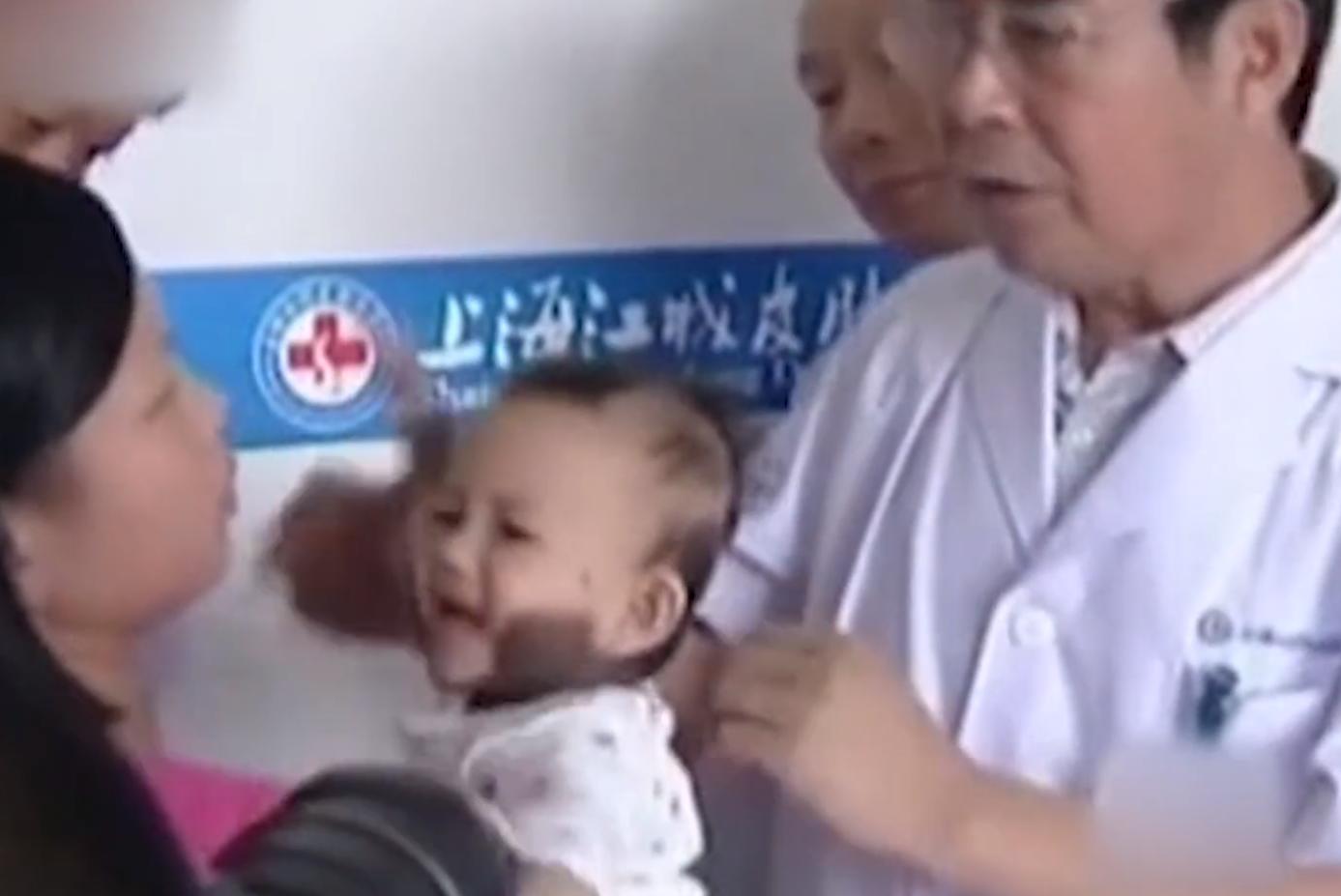 刚出生的小孩皮肤有黑斑,全身长满黑斑的小孩后来怎样了