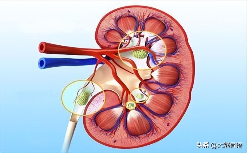 手指痛风的初期症状和治疗,脚踝痛风的症状和治疗方法