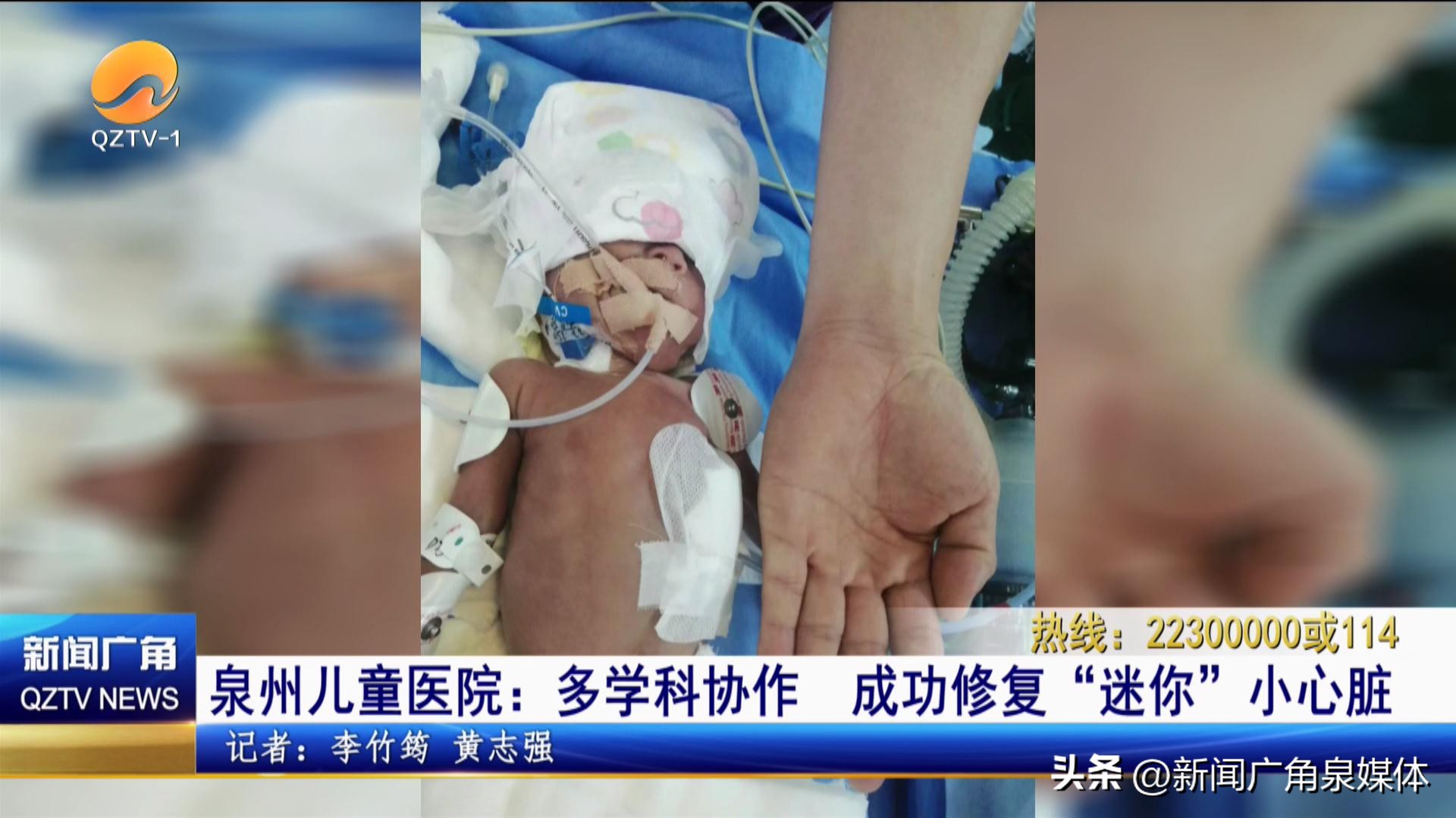 福建省儿童医院心脏介入,泉州儿童医院心外科