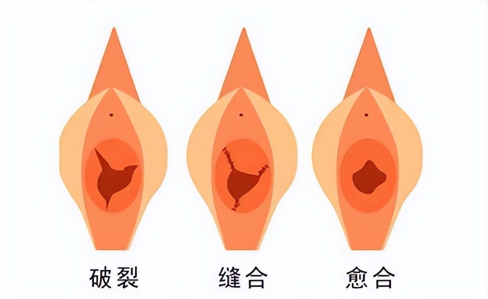 13岁女孩肠痉挛怎么回事,13岁女孩肠痉挛犯了怎么办