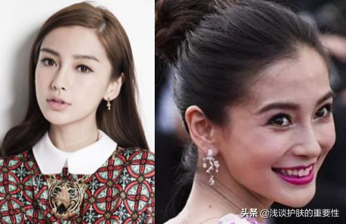 去掉眼纹会不会更显年轻,有眼纹和眼袋哪个更显老