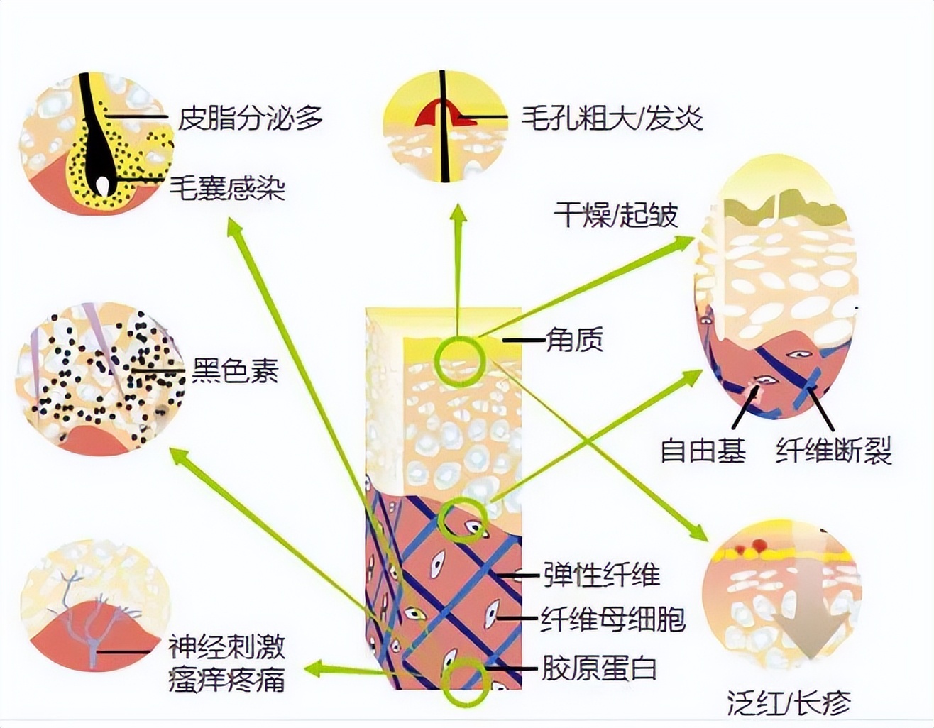 秋季过敏性哮喘几月开始用药,过敏性鼻炎和过敏性哮喘联合用药