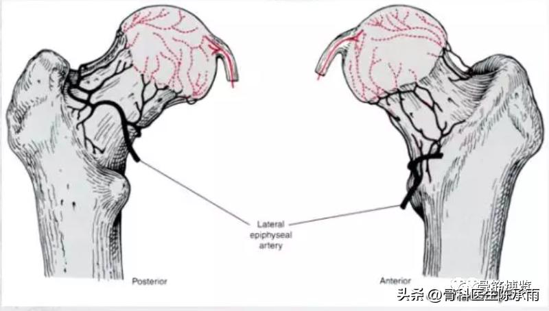 股骨颈闭合复位内固定术后护理,股骨颈骨折闭合复位的技巧