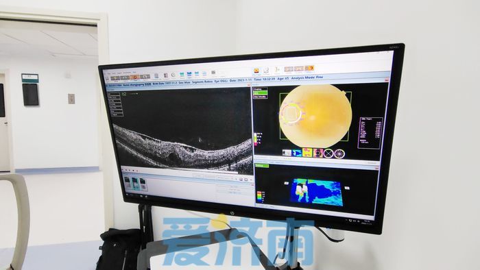 济南市莱芜人民医院高质量学科巡礼｜眼科：大医精诚奋战在“光明”道路上的开拓者