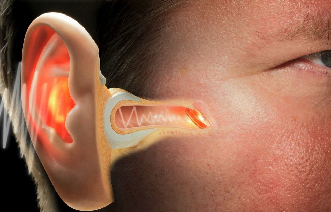 耳朵经常用棉签掏觉好痒怎么办,耳朵老是痒天天都要掏怎么回事