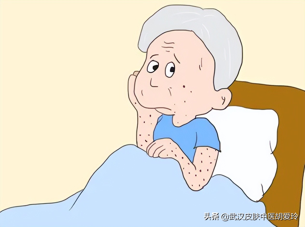 小腿上长了个褐色疙瘩,小腿有褐色凸起痣