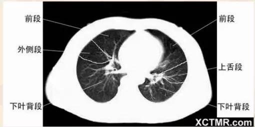 胸腹部盆腔ct主要检查什么,女性盆腔ct断层解剖结构图