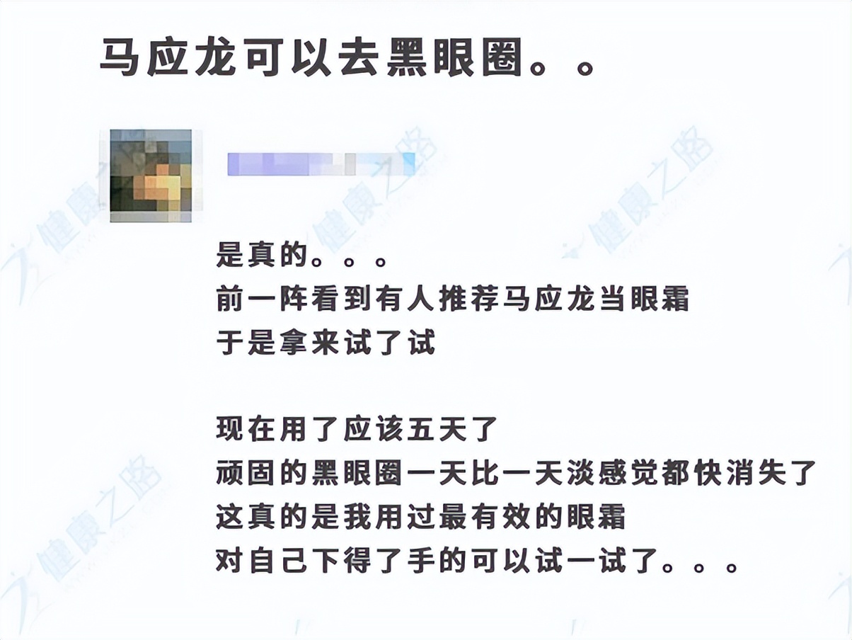 肾虚导致的黑眼圈属于哪种黑眼圈,有黑眼圈该怎么办才能消除黑眼圈
