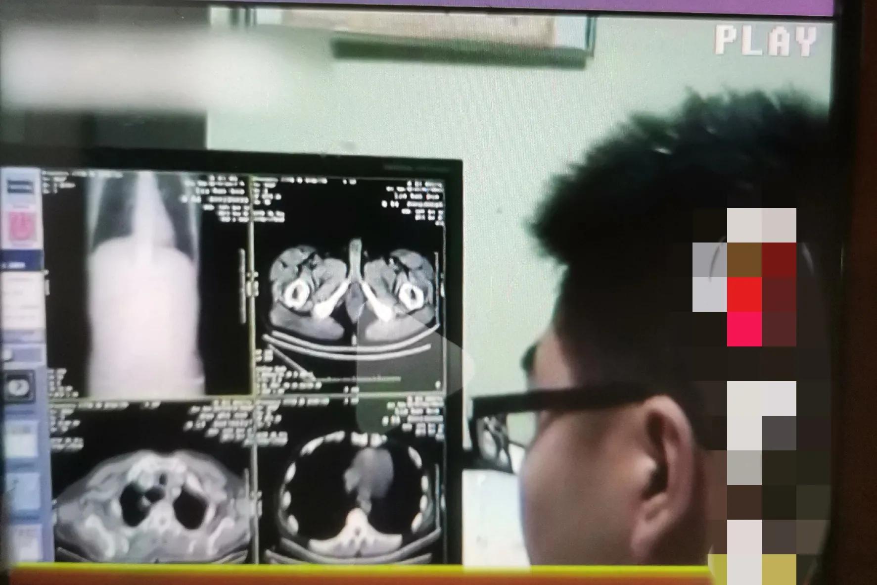 妻子和前夫色聊，现任为了惩罚妻子，将她*裤内**涂上农药，酿成大祸