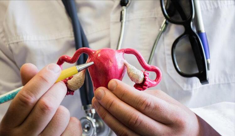 卵巢癌是“沉默的杀手”，病发时除了腹痛，还需留意3种异常