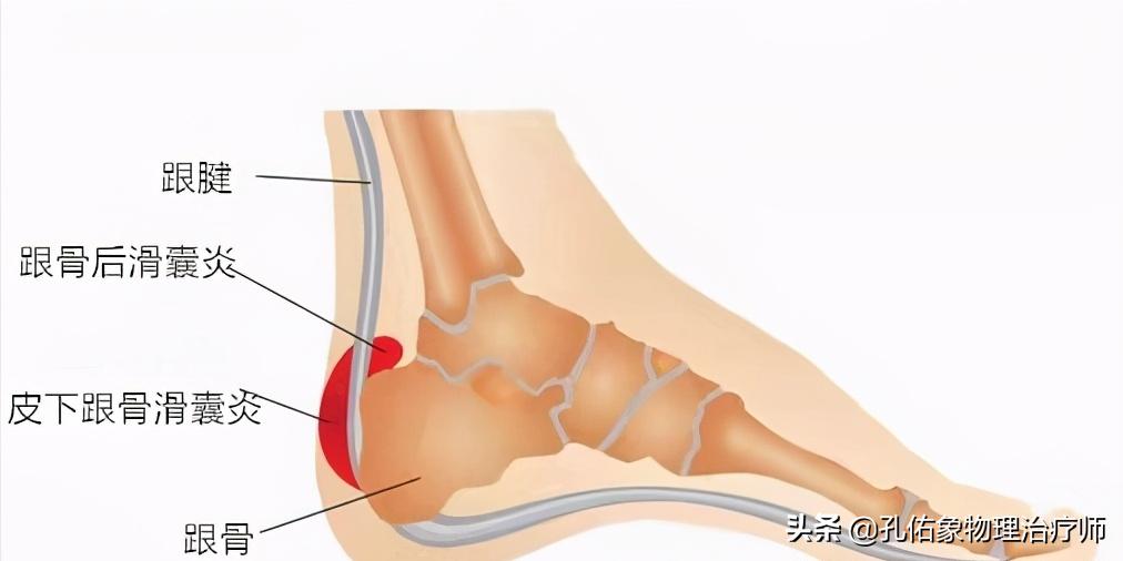 中老年人脚底痛是什么原因,老人脚底板好疼是什么原因