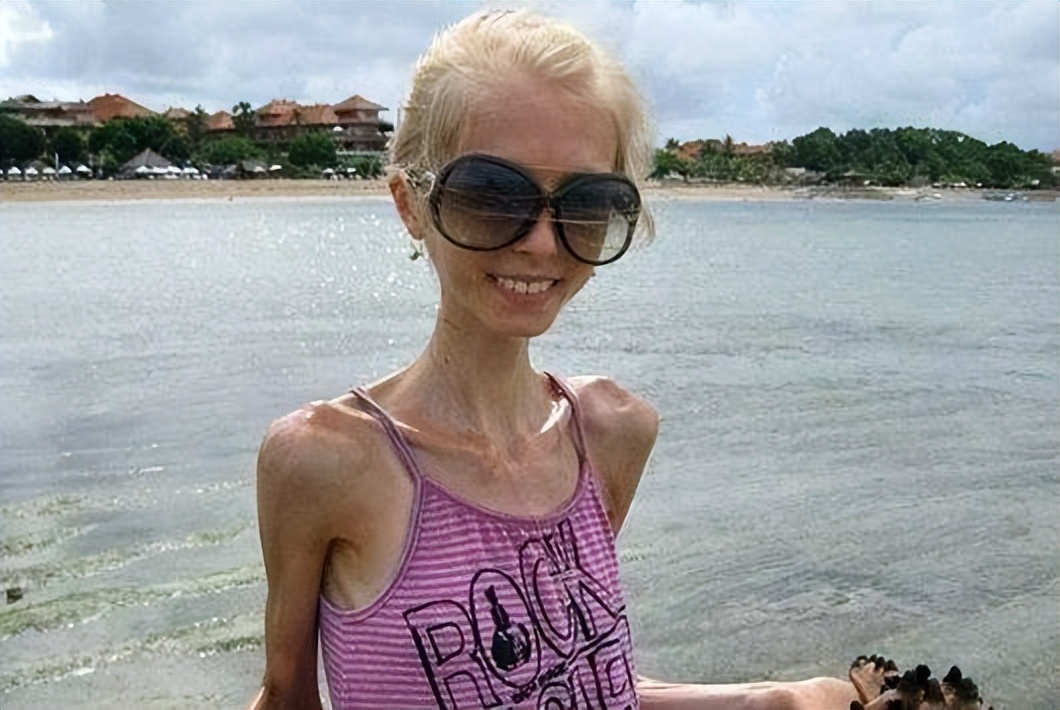 感染艾滋病会死亡吗,感染艾滋病一般人能活多久