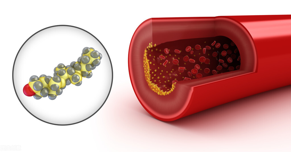 心脏引起脑供血不足的症状有哪些,气血两虚的脑供血不足症状有哪些