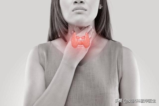 脱发头发出油原因有三种,头皮干了会脱发还是油了会脱发