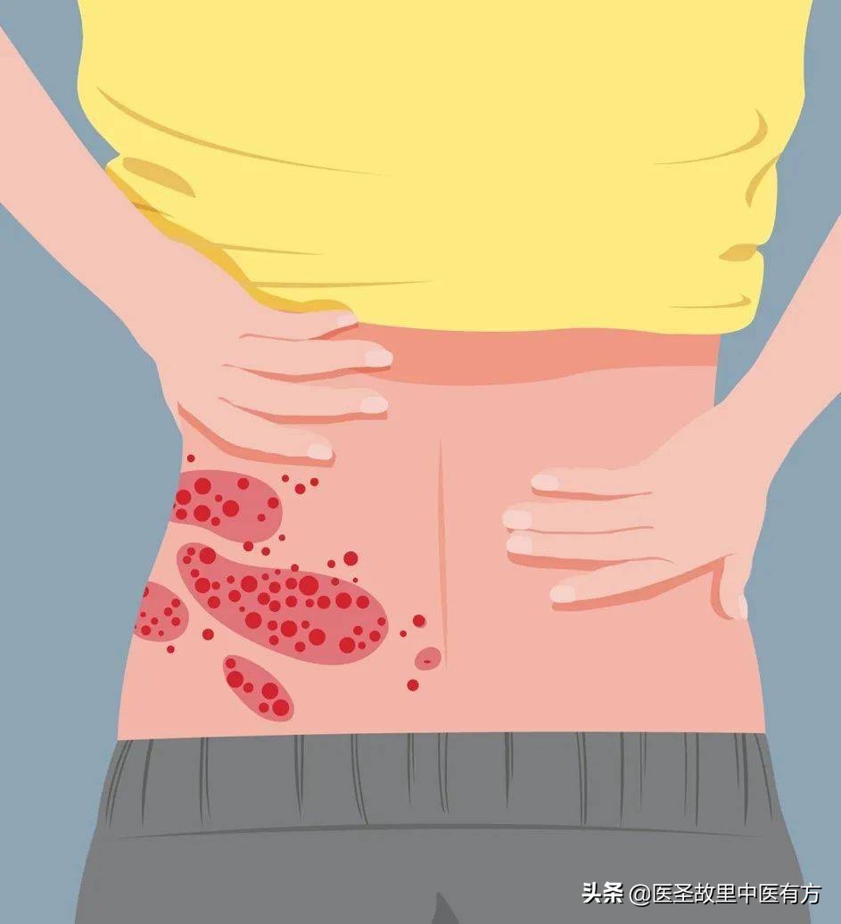 腹痛、胃痛、肋痛、经痛？中药止痛名方金玲子散，一方两药解百痛