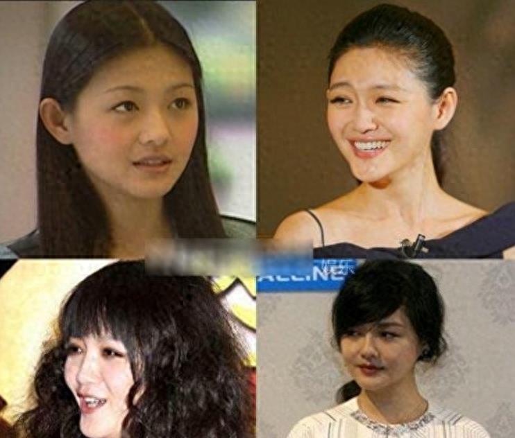 瘦到病态的审美,瘦到病态