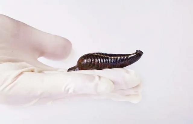蚂蟥被吸进肚子里还能存活吗,山里的泉水有蚂蟥吗