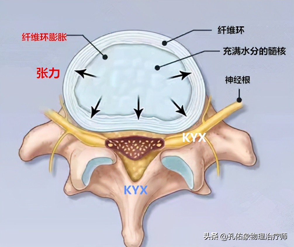 腰椎间盘突出要怎么治疗才好得快,腰椎间盘突出3个方法标本兼治