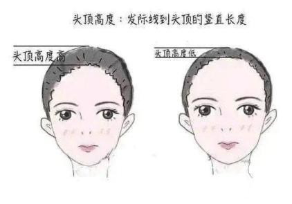颅顶高发际线低怎么办,颅顶低降低发际线