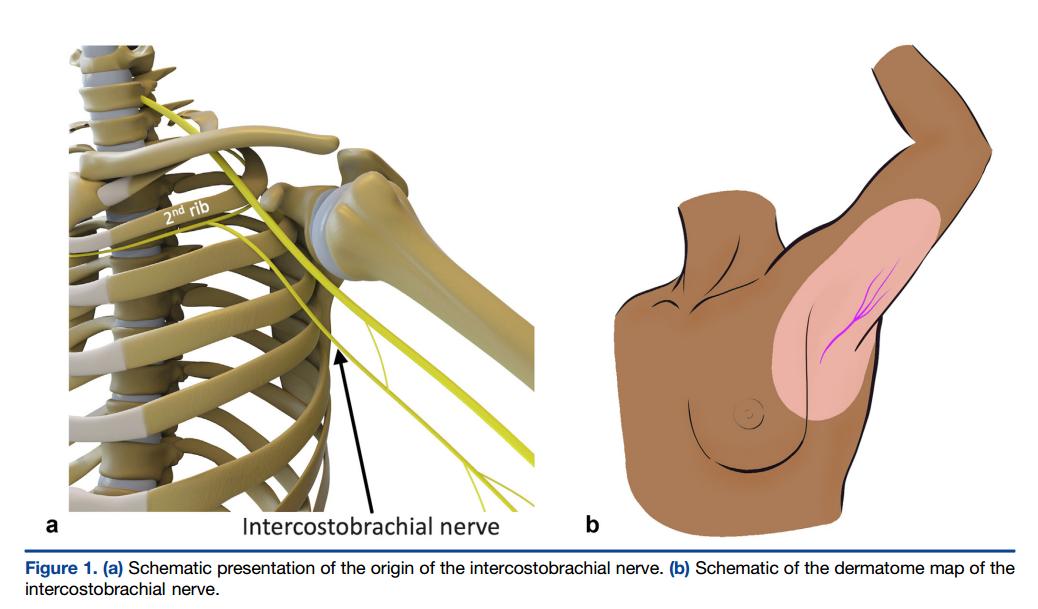 介入科治疗乳腺癌,介入疗法治疗乳腺癌