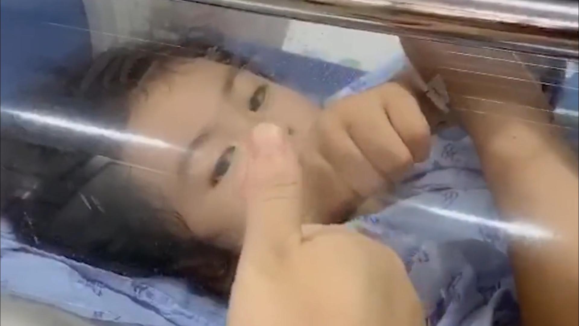 5岁女孩练舞瘫痪康复,8岁女童练舞蹈瘫痪