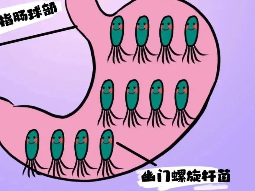 田艳涛谈早期胃癌治愈率,田艳涛医生谈胃癌