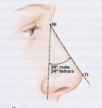 【协和科普】同是隆鼻，为什么有的自然有的一眼被看穿？