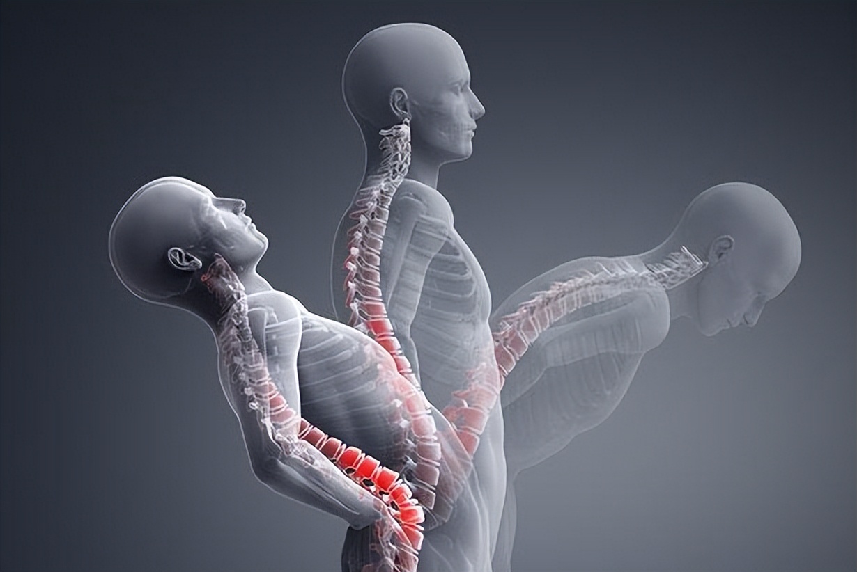 治疗强直性脊柱炎必须按体质治吗,针对强直性脊柱炎最好的锻炼方法