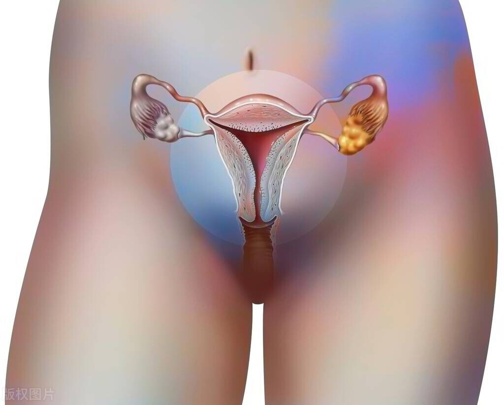 37岁女子与丈夫同房后，发现少量出血，医生：都是这种病惹的祸