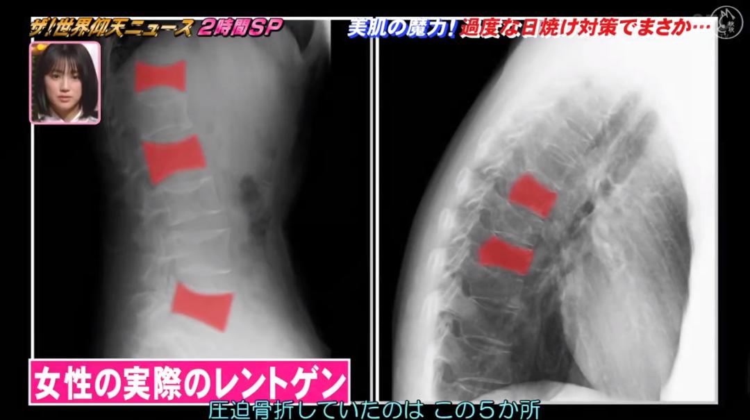 日本漂亮小姐姐不想被晒黑，每天全副武装！2年后身高竟缩水7cm…
