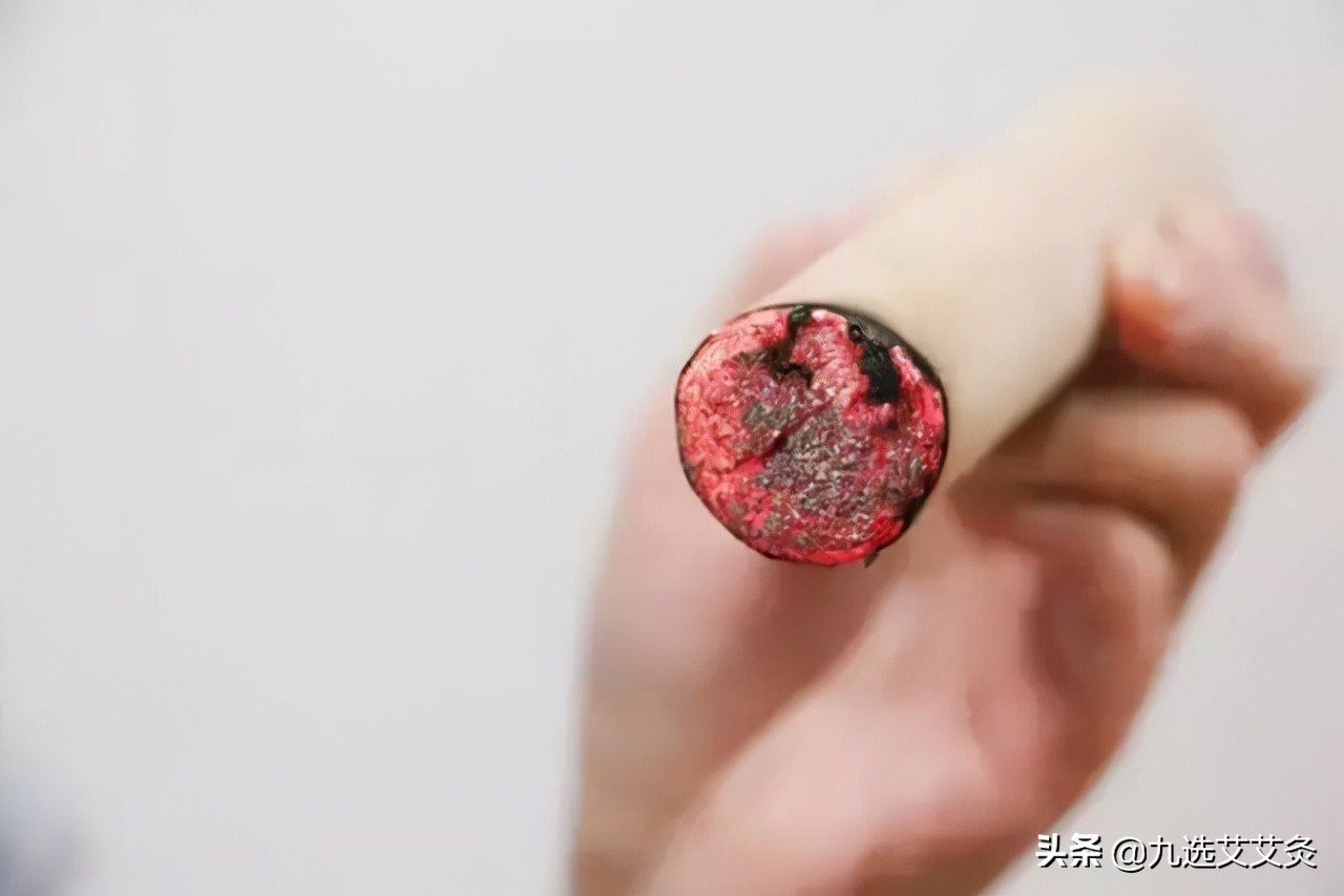 风疹可以熏艾灸吗,祛湿疹的艾灸位置图