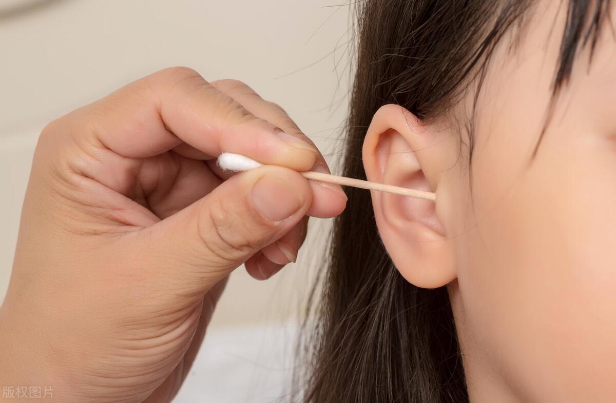 耳屎越掏越多生物学上叫什么现象,耳屎突然增多可能是四种疾病