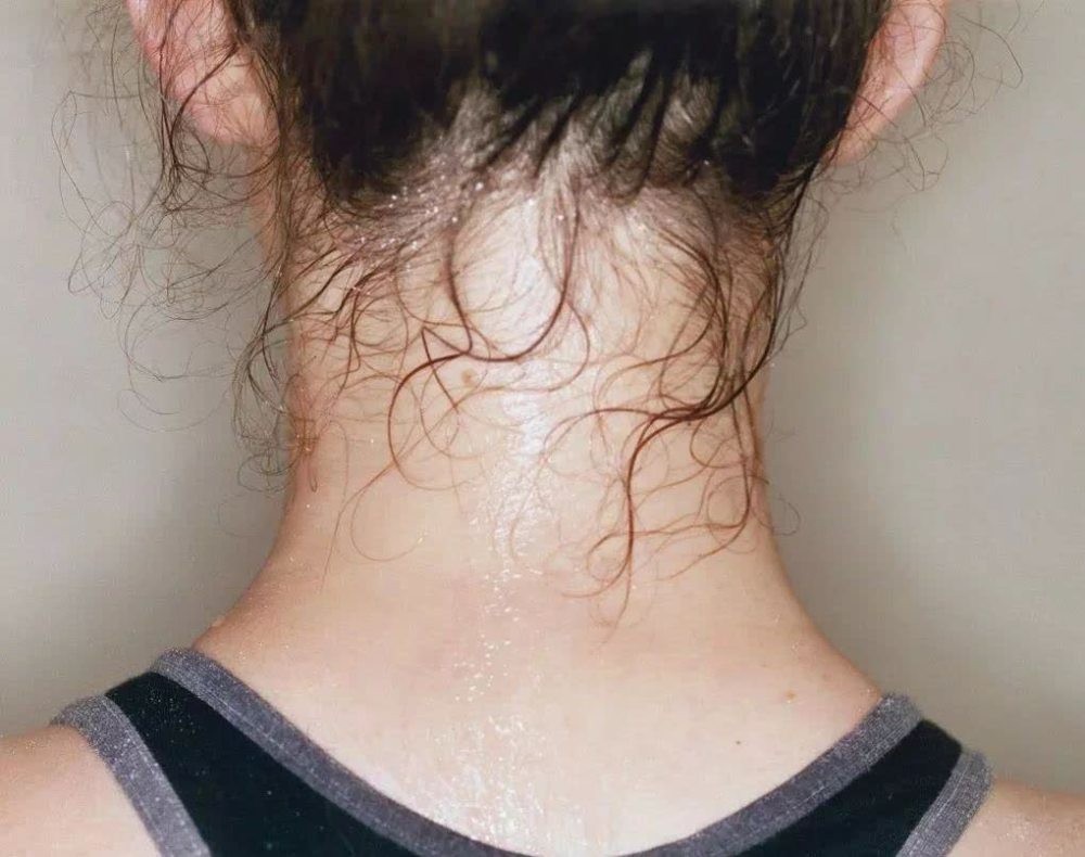 6种出汗暗示身体有大问题,4个部位出汗或暗示身体出问题了