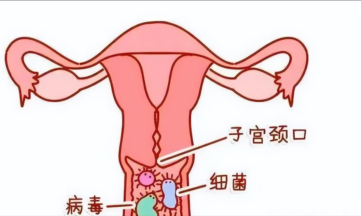 hpv11阳性非典型鳞状细胞,男性hpv11阳性算不算严重
