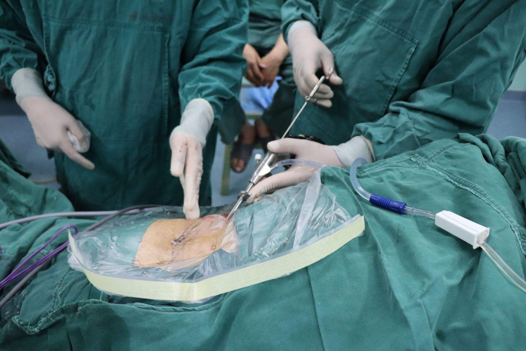 单孔腹腔镜的技术优势有哪些,有关妇科单孔腹腔镜手术的科普