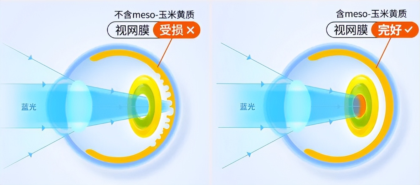 蓝光盾叶黄素软糖儿童,inne蓝光盾软糖叶黄素