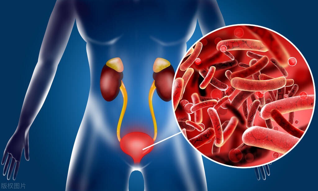 尿路支原体感染抗生素一般用几天,尿路感染抗生素有哪些使用原则