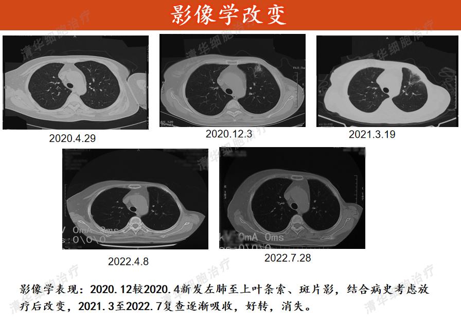 乳腺癌靶向药用后腰疼是什么情况,乳腺癌靶向治疗期间可以吃中药吗