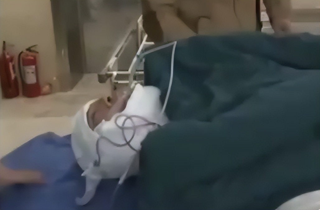 男子喝酒脖子成河马,喝酒喝成河马脖子病