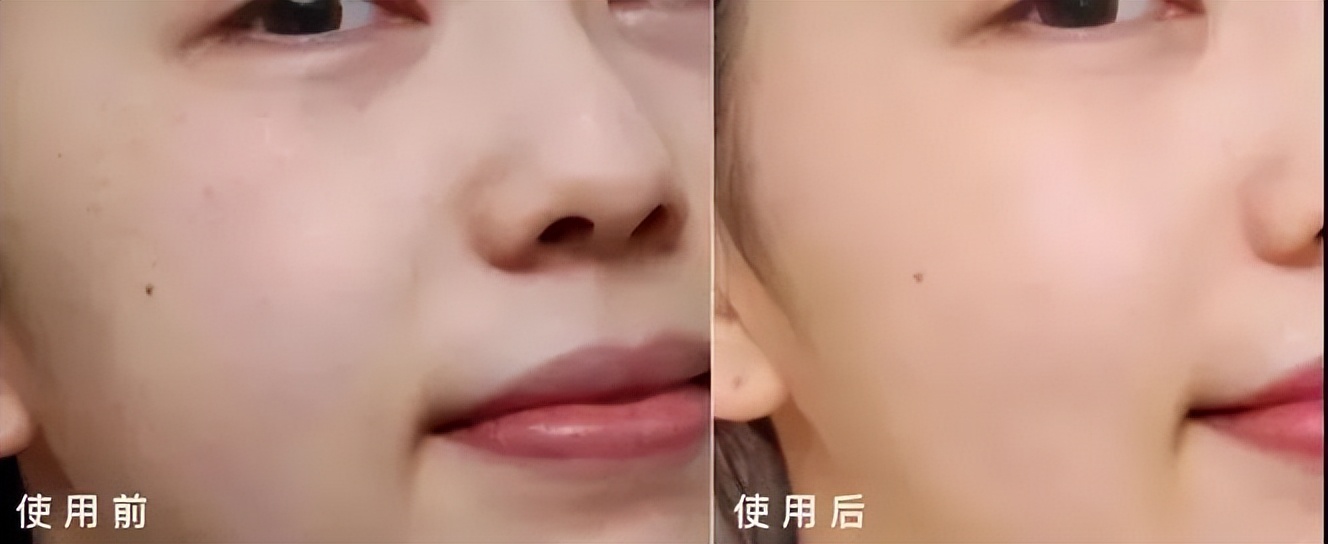 韩国东星小黑瓶祛斑霜，​韩国东星制药60年口碑企业出品！