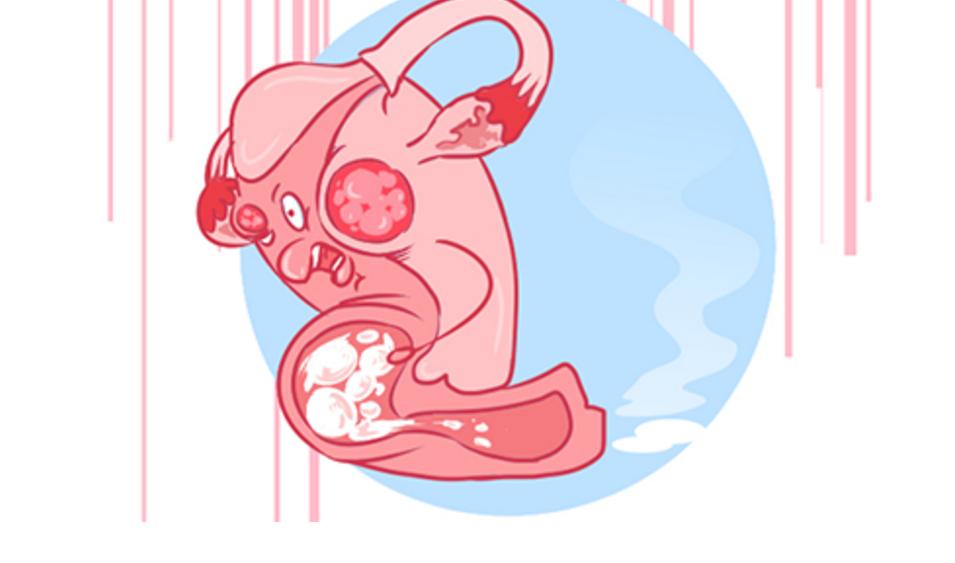 内裤好多分泌物代表什么,女性裤头总有异味怎么回事