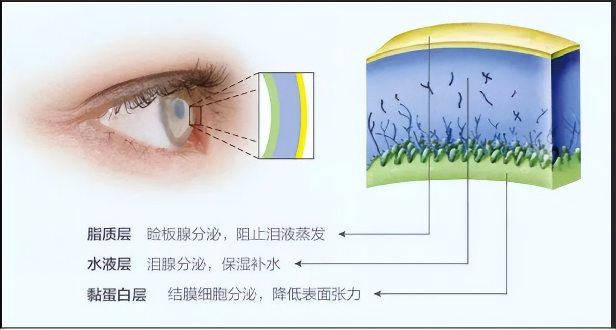 刷手机眼睛越看越模糊,看手机眼睛干涩用什么眼药水