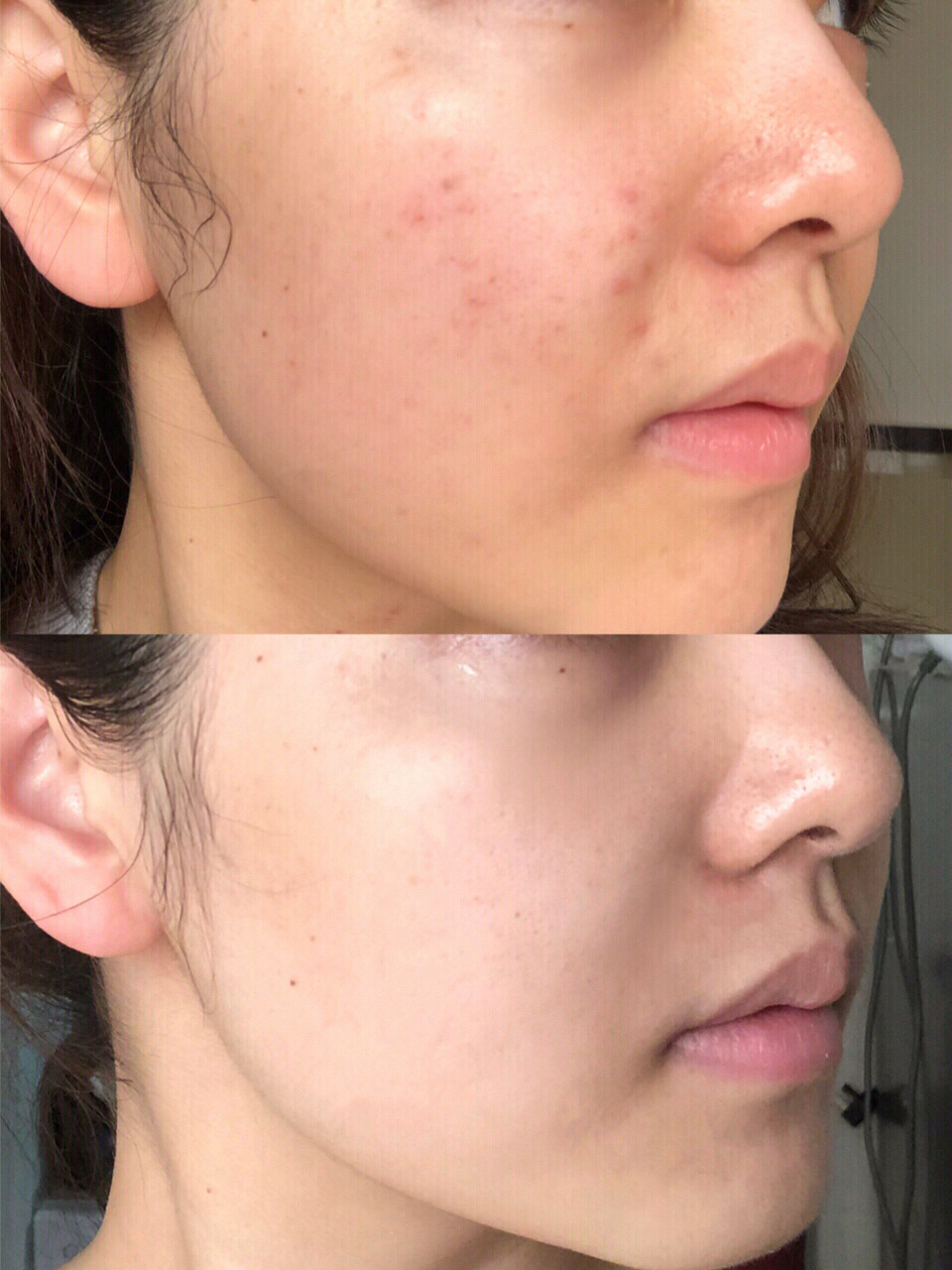 瓷妆依克多因精华好用吗,瓷妆依克多因舒润特护精华液测评