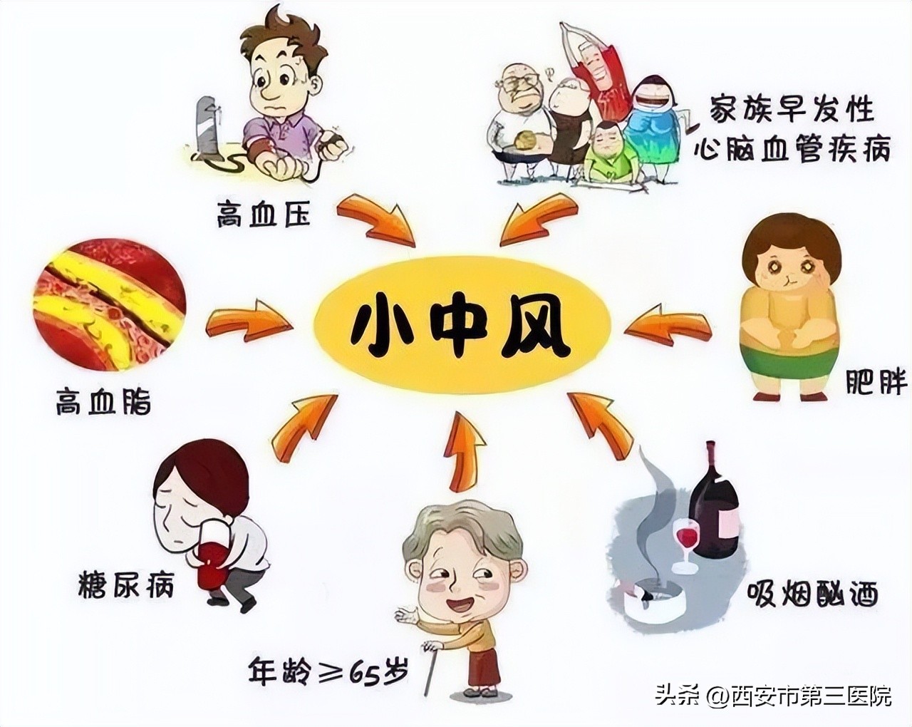 脑健康科普案例,脑卒中健康科普3分钟素材