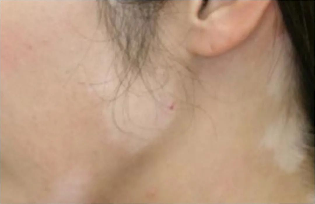 用护肤品浪费钱吗,用护肤品不要吝啬