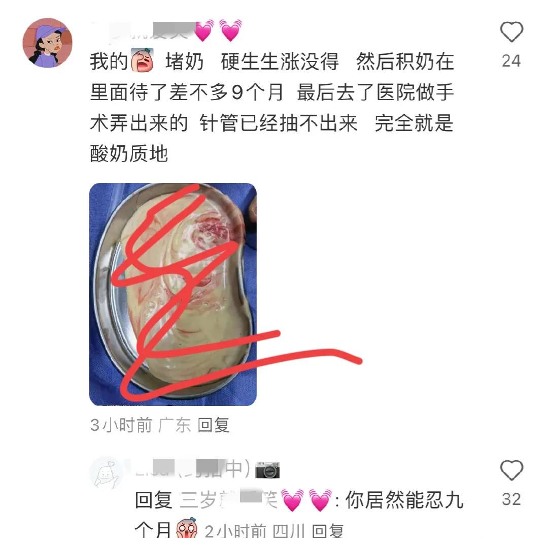 哺乳期堵奶化脓一定要切开引流吗,哺乳期堵奶化脓做穿刺多久可以好