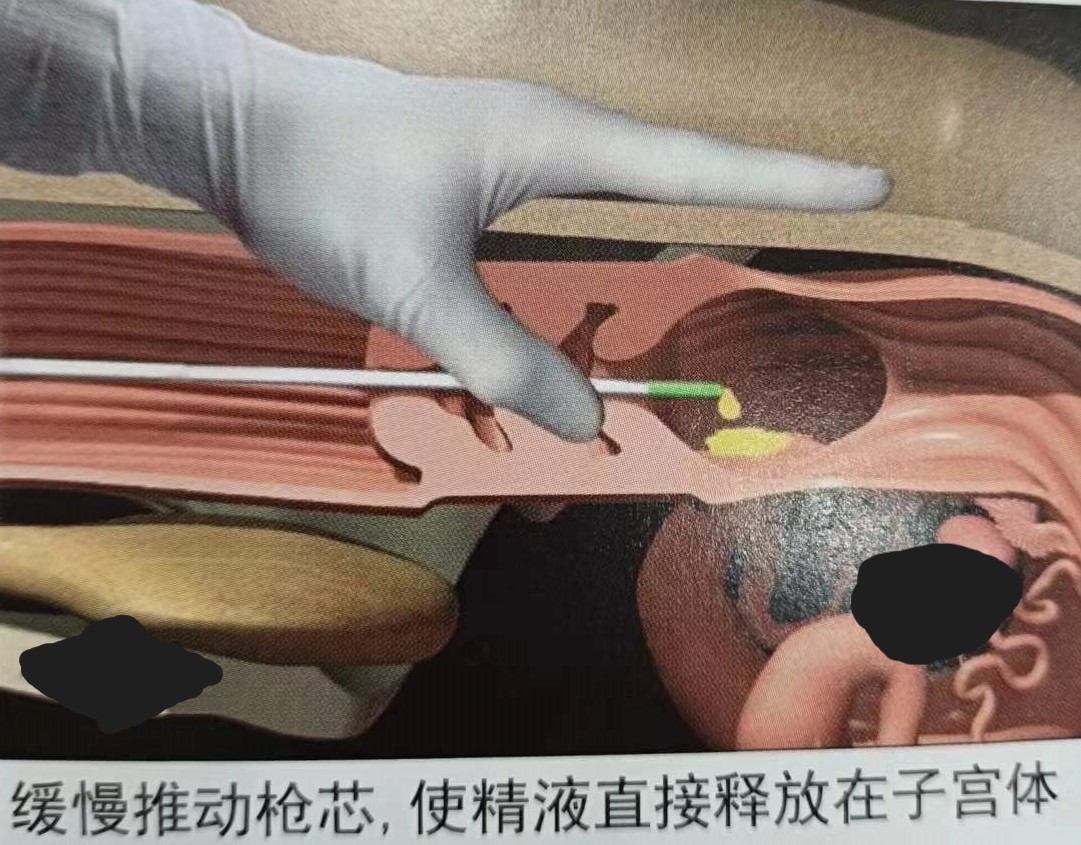 如何提高母牛同期的繁育能力,如何提高母牛受孕率