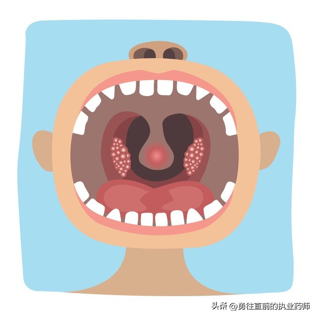 疱疹性咽峡炎中药方,中医治疗疱疹咽峡炎的最佳方法